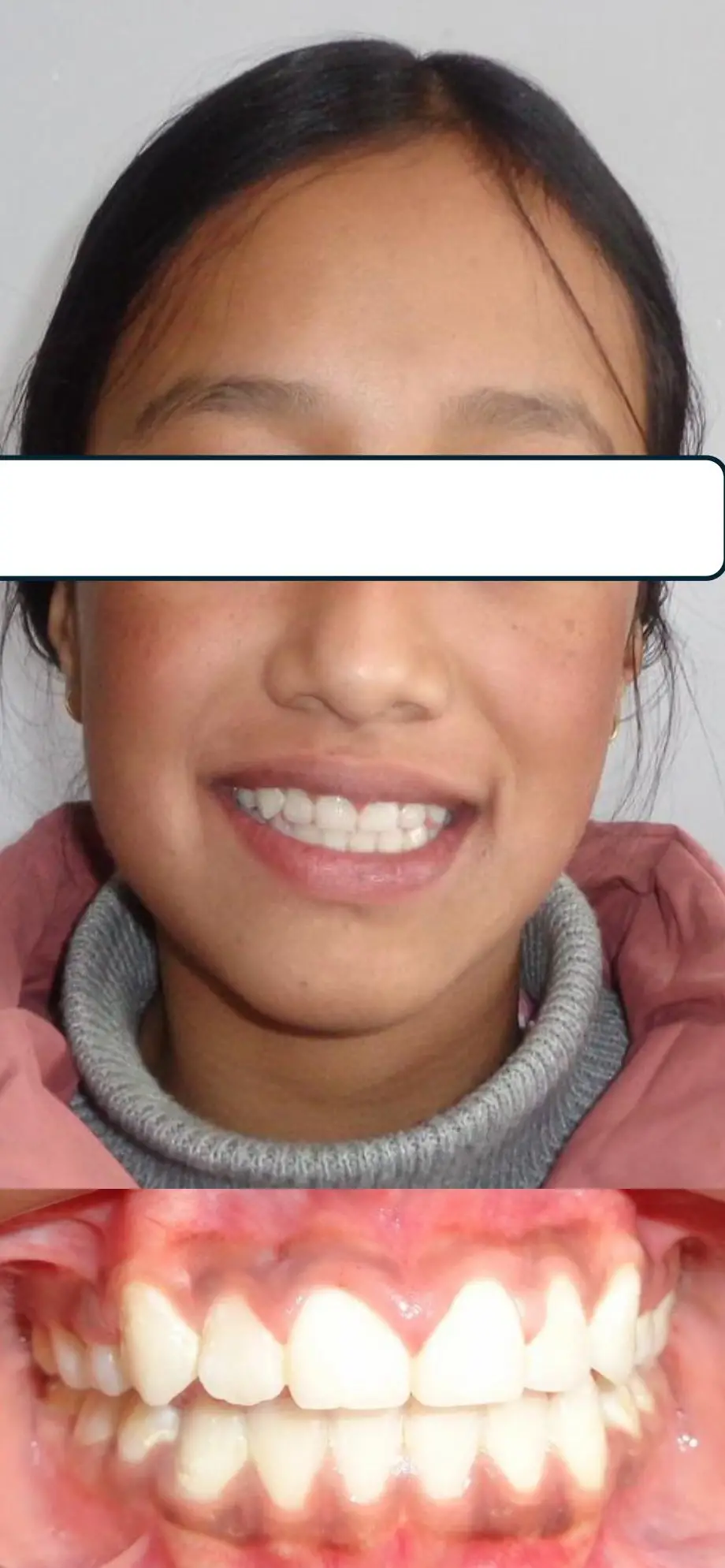 file (2)-images-2222.webp
